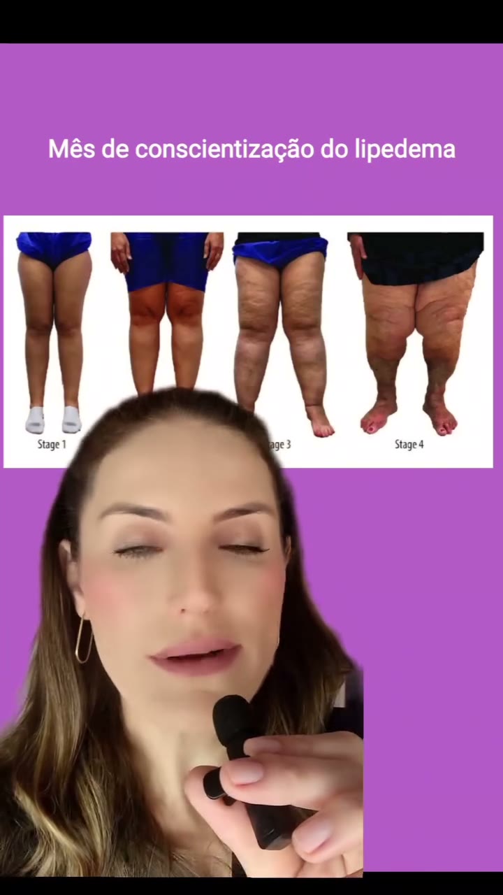 #lipedemaawareness #lipedema #junho