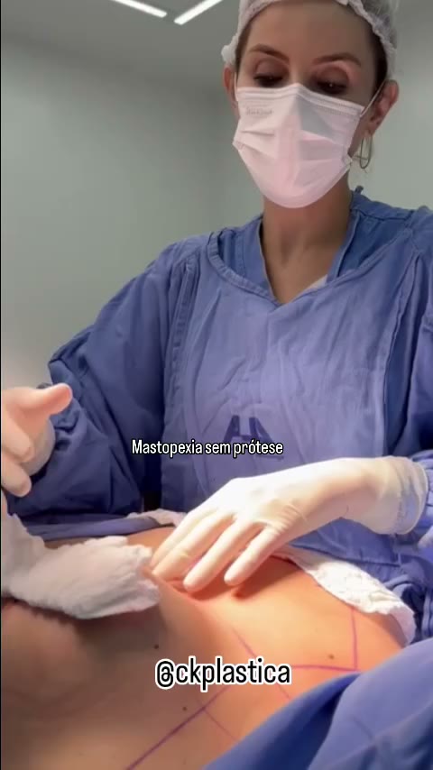 Mostrando um lado já realizada a mastopexia e outro ainda não? Gostam de conteúdos assim?
