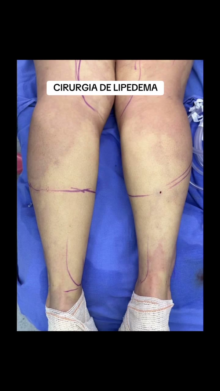 Legs have many anatomical details, making surgery challenging.