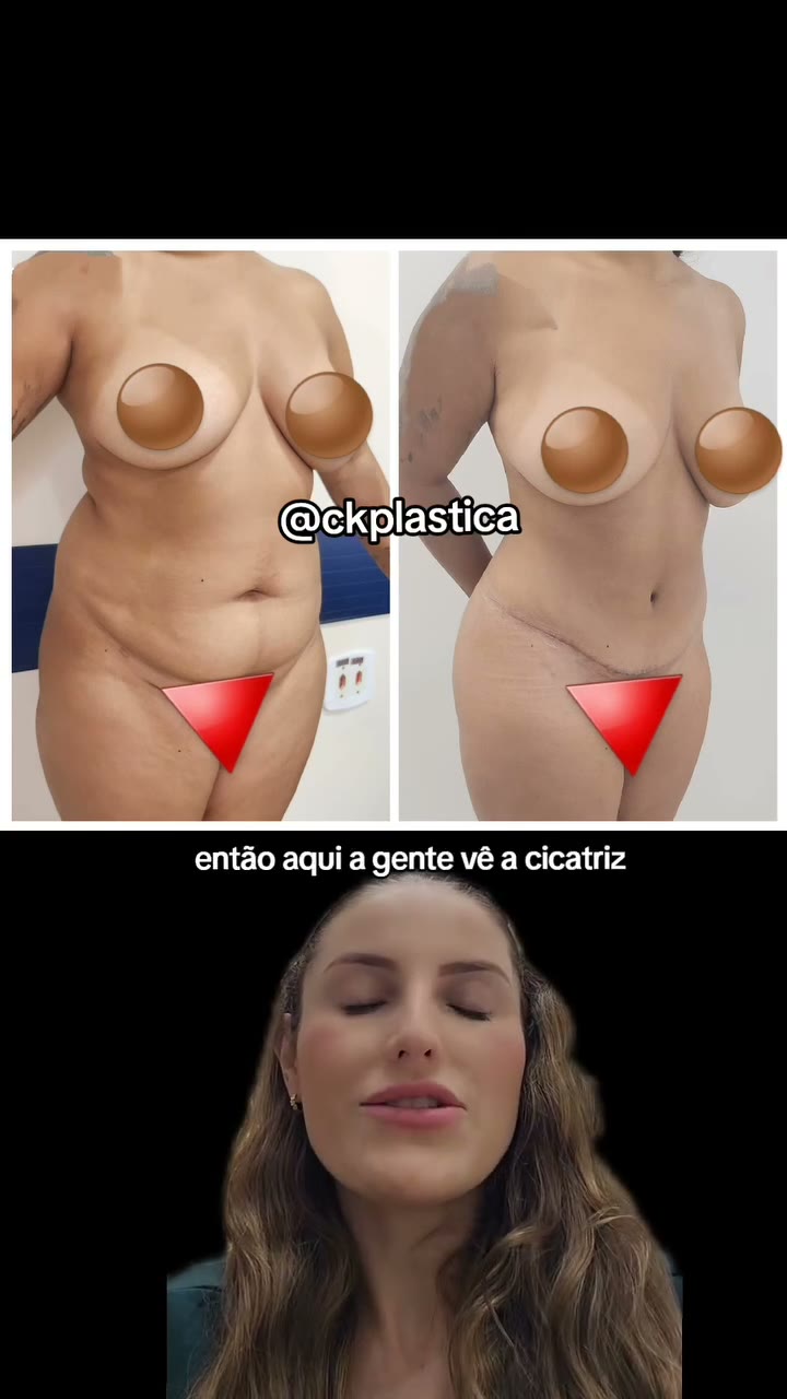 ¿Cree que una cirugía así puede ayudar a transformar la vida de una persona?