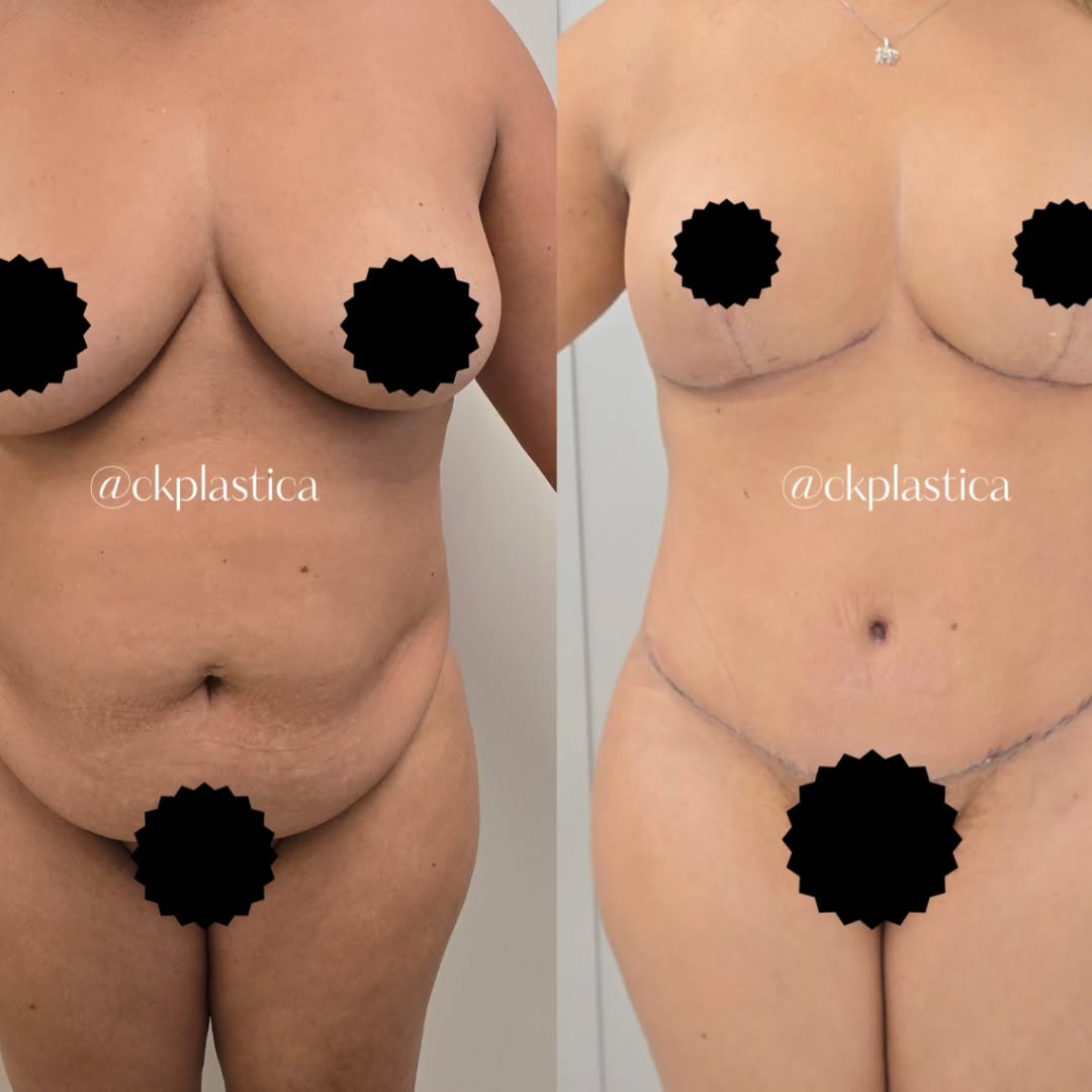 Post do Instagram @ckplastica