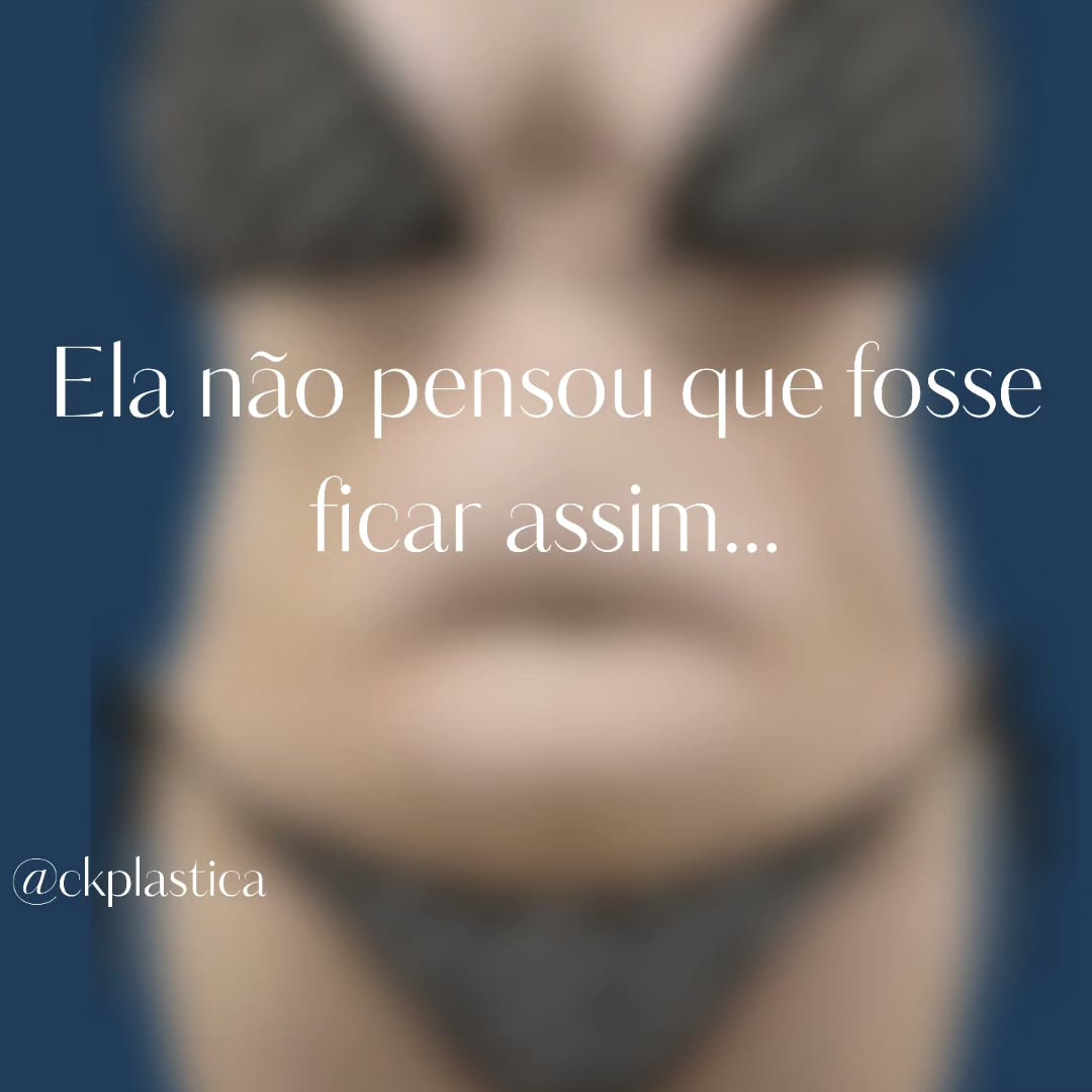 Post do Instagram @ckplastica