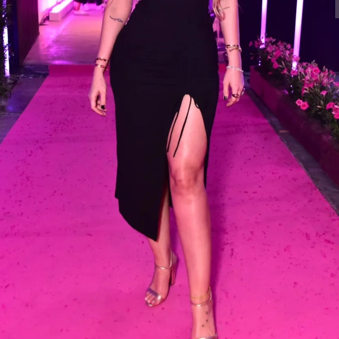 Según la propia @yasminbrunet, ella es portadora de Lipedema. (3/3)