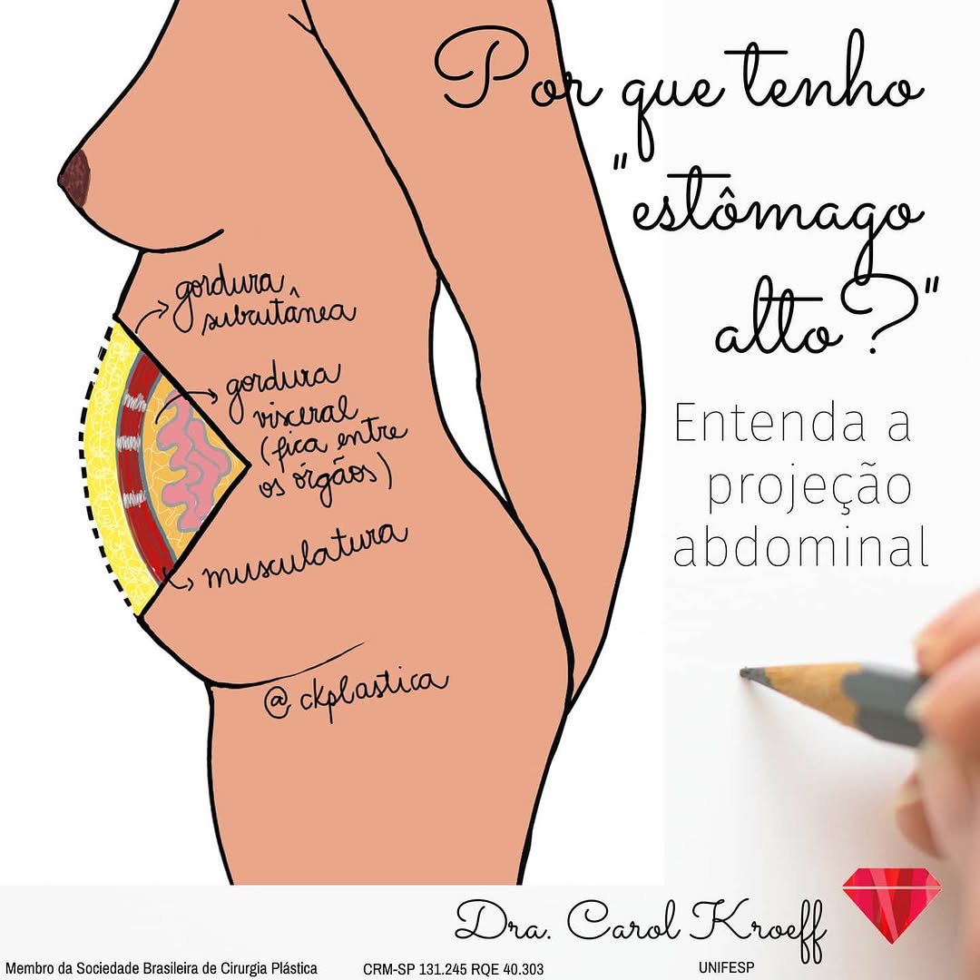 Para entender por que o abdome pode ser mais volumoso é importante saber o que pode estar acontecendo lá dentro.⁣ (1/2)