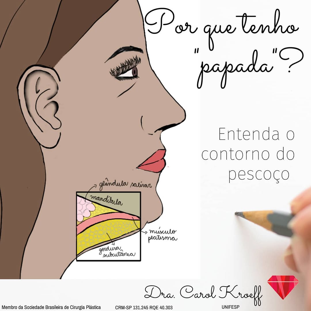 Não é tão simples quanto parece. (Vídeo completo após 1 minuto no IgTV). A famosa “papada envolve várias camadas, e  (1/2)
