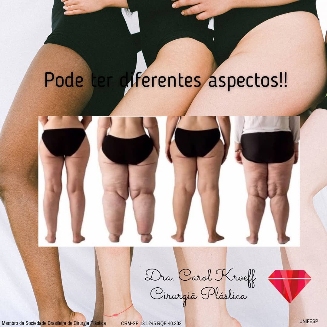 “Dra eu nunca usei bota”, (7/10)