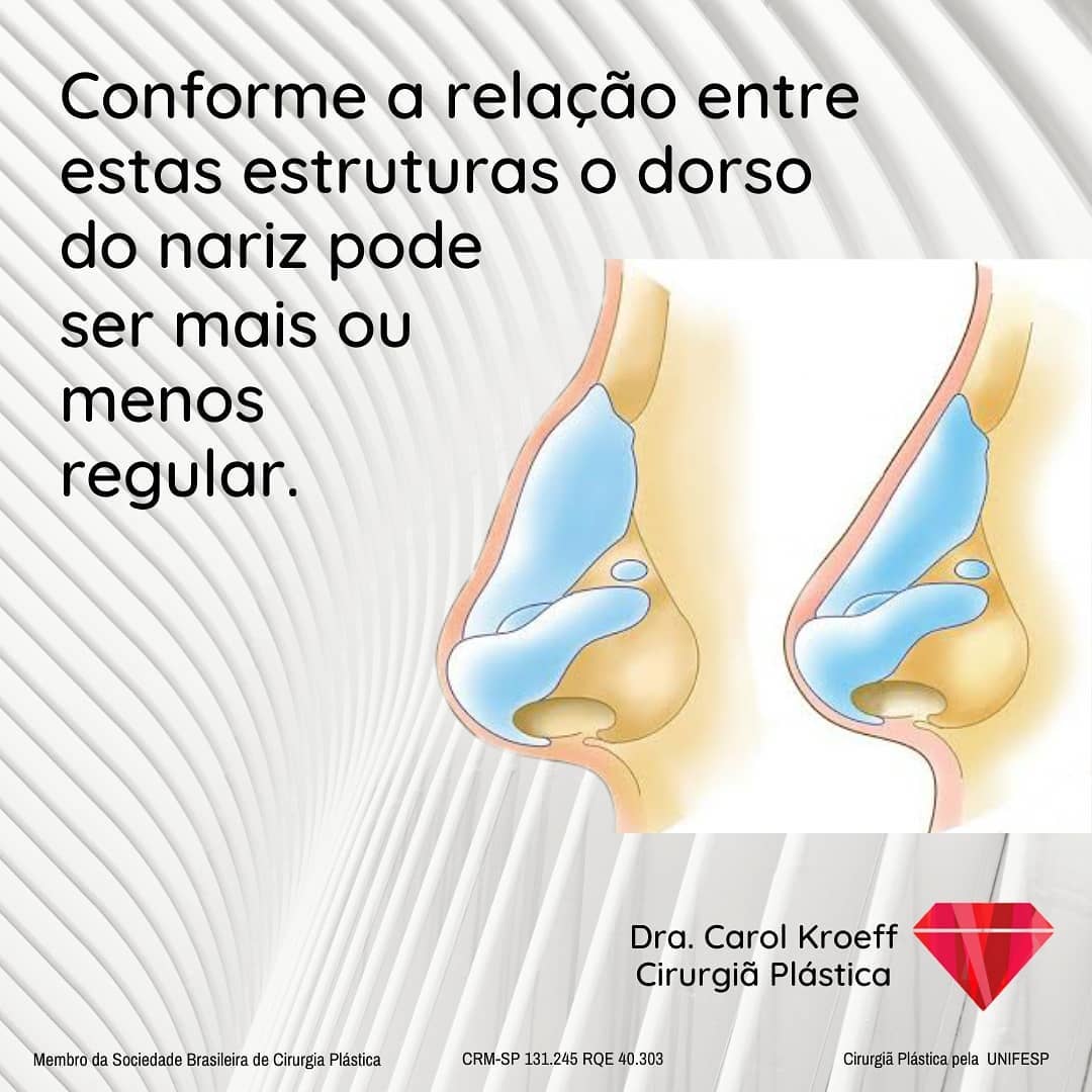 O tratamento cirúrgico ou não do nariz envolve planejamento e um traten to individualizado. Amo quando podemos trazer mu (3/10)