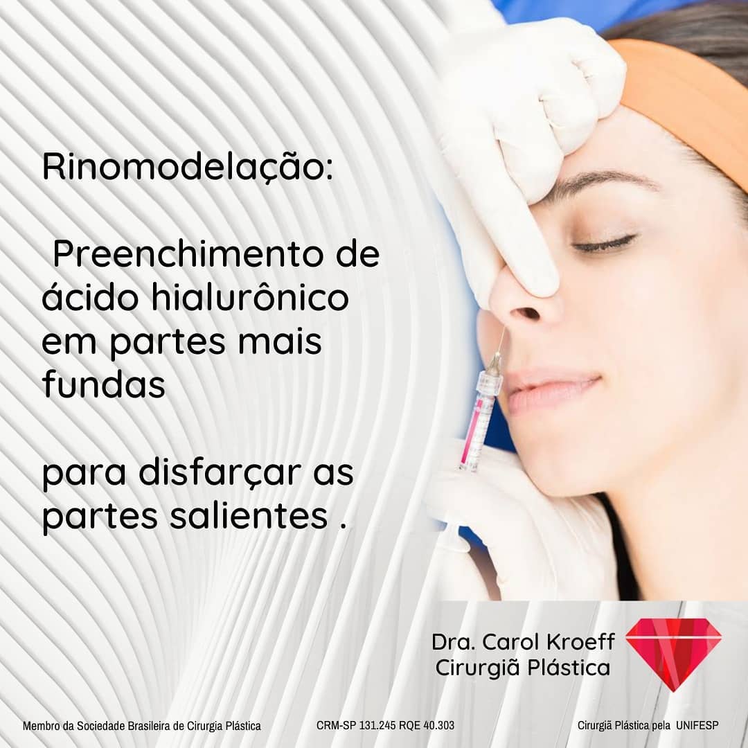 O tratamento cirúrgico ou não do nariz envolve planejamento e um traten to individualizado. Amo quando podemos trazer mu (4/10)