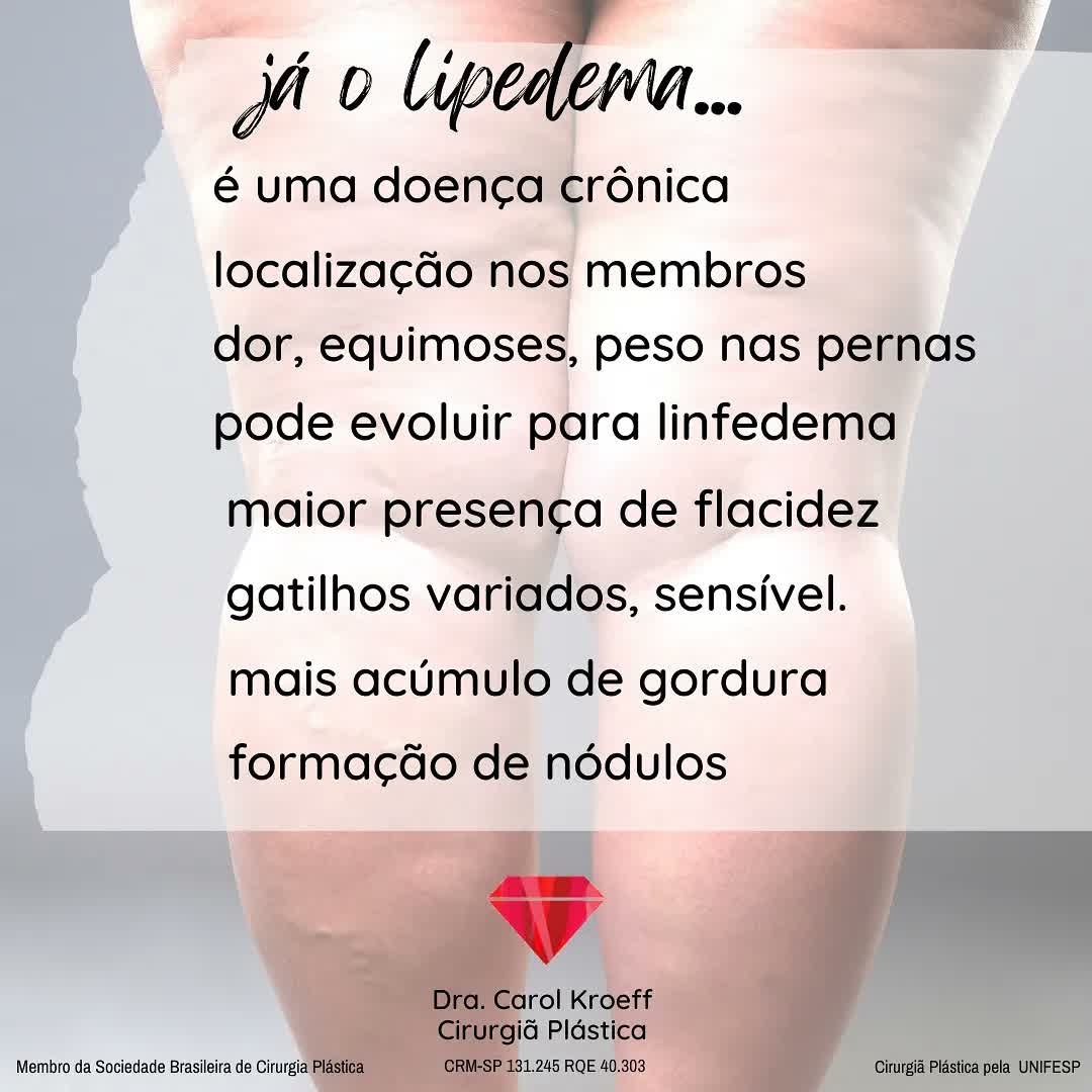 Sei que hoje seria um dia de #tbt mas resolvi trazer esse assunto por um motivo: há muita dúvida. Da mesma forma que mui (3/5)