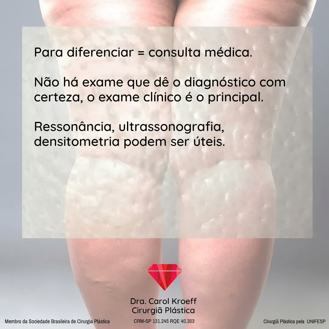 Sei que hoje seria um dia de #tbt mas resolvi trazer esse assunto por um motivo: há muita dúvida. Da mesma forma que mui (5/5)
