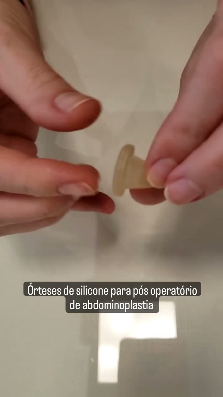 Os plugs ou órteses de silicone para umbigo são dispositivos indicados a critério médico conforme a técnica utilizada na
