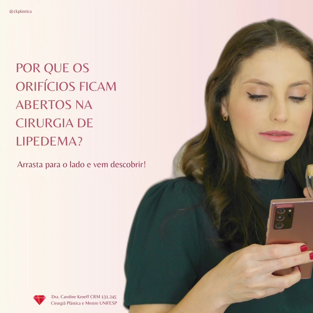 Perguntinha que recebo com frequência! (1/7)