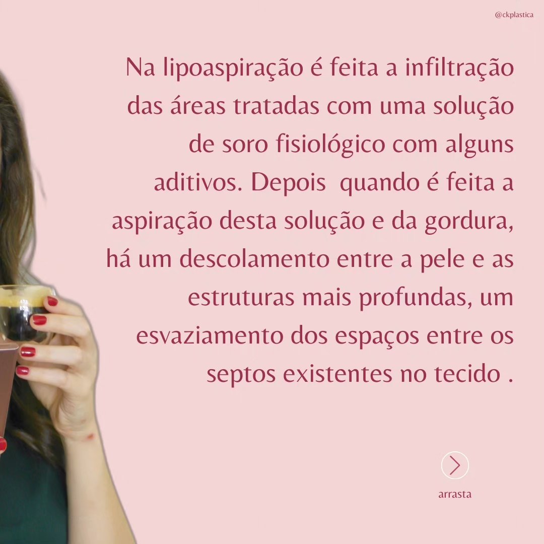 Perguntinha que recebo com frequência! (2/7)
