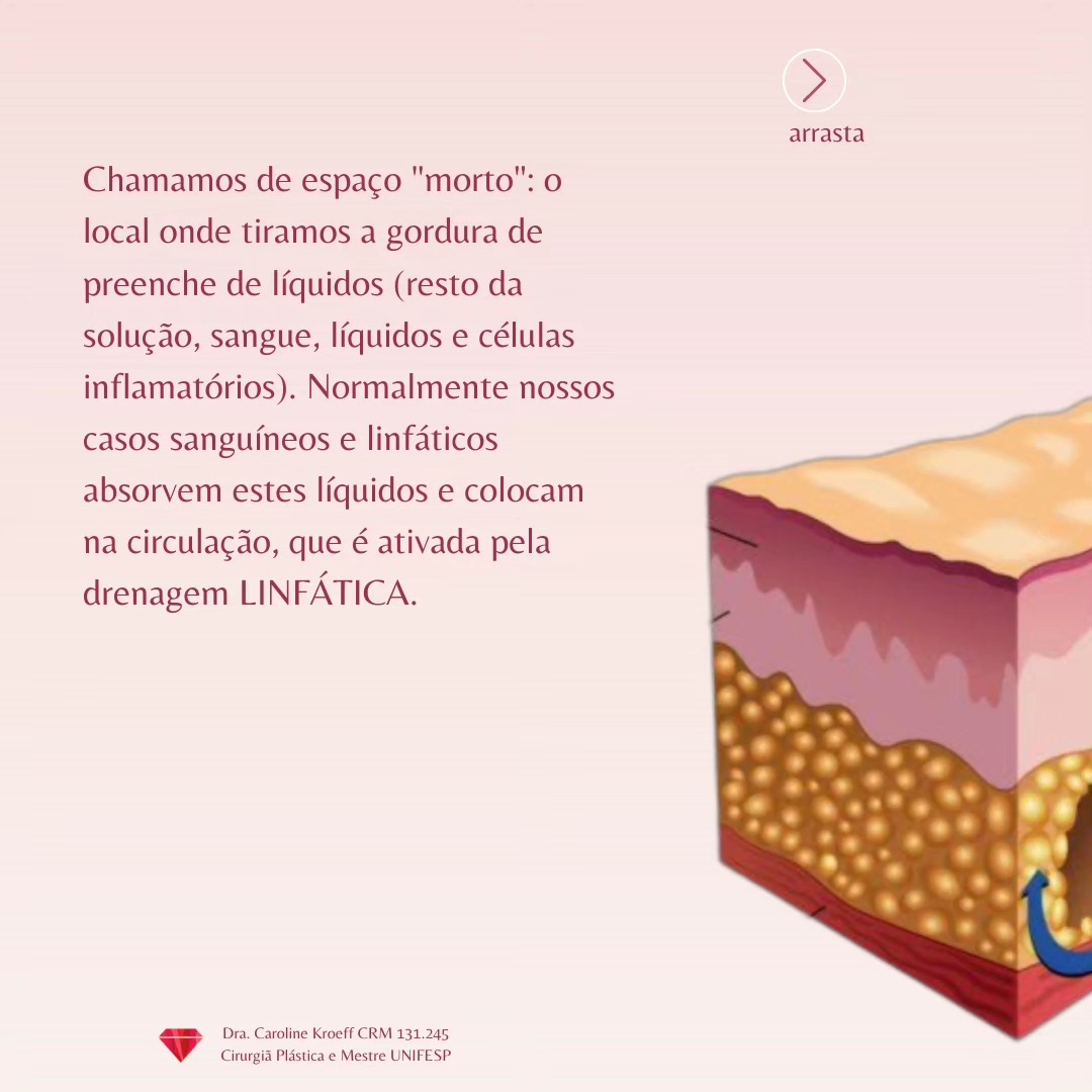 Perguntinha que recebo com frequência! (3/7)