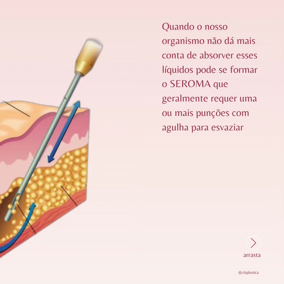 Perguntinha que recebo com frequência! (4/7)