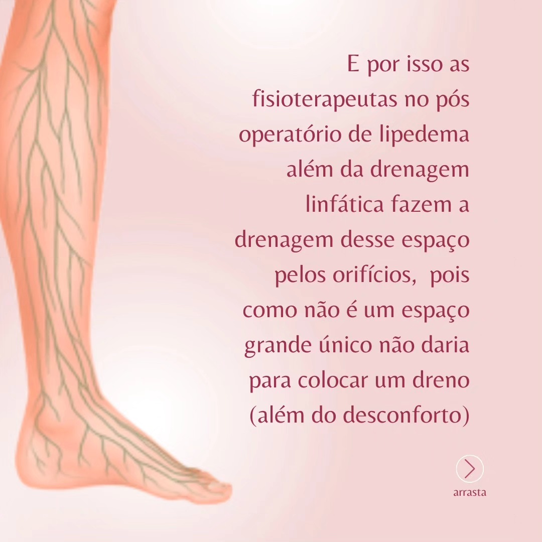 Perguntinha que recebo com frequência! (6/7)
