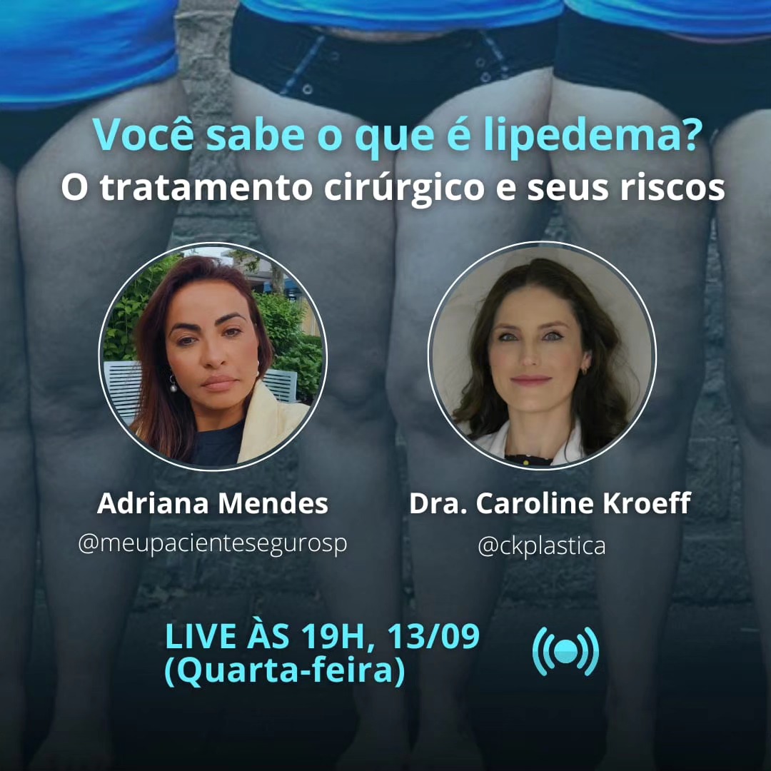 Don’t miss today’s live on surgical treatment for lipedema.