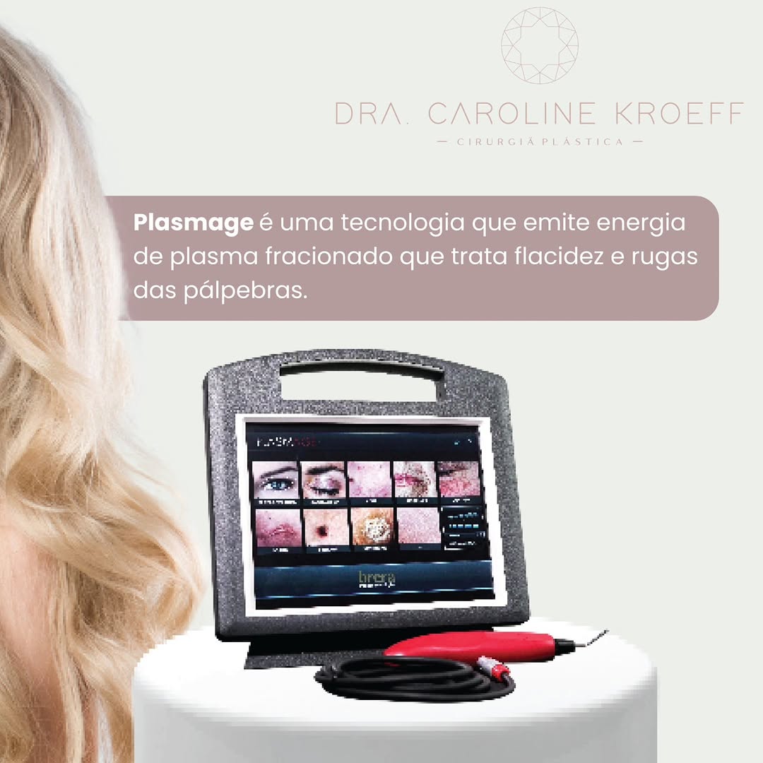 ✨ Plasmage: Tecnologia no Rejuvenescimento da Região Palpebral! ✨ (2/4)
