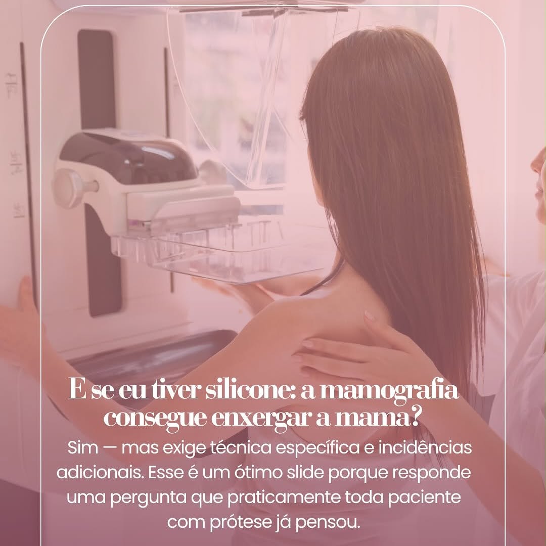 Post do Instagram @ckplastica